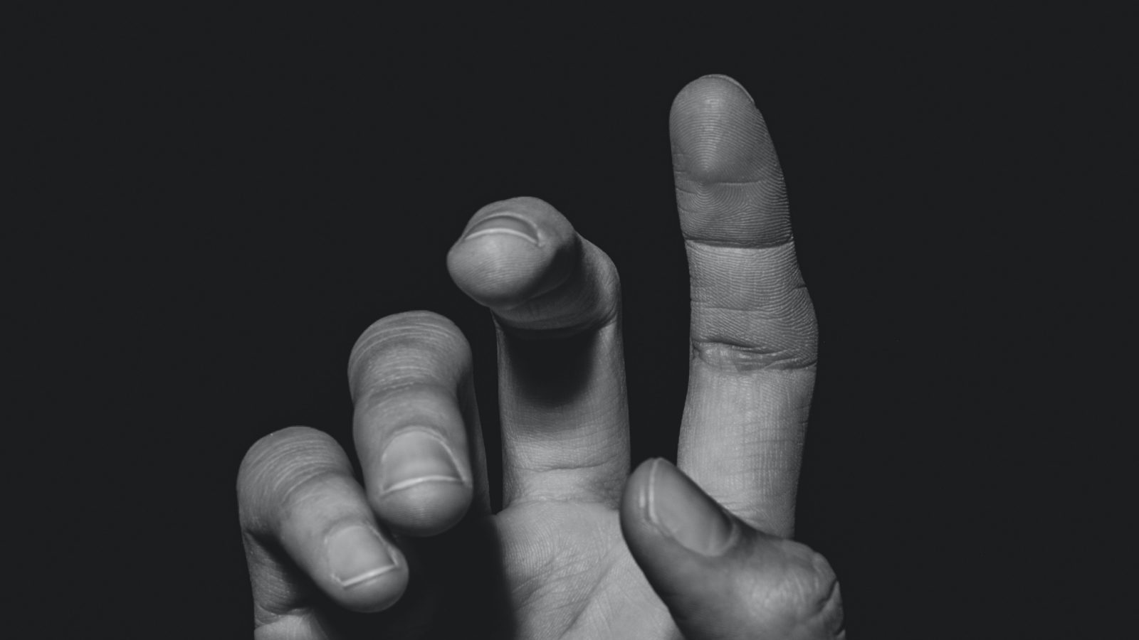 a finger that looks like it hurts